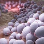 Estima Medical Group, produse pentru prevenirea infectiilor, diagnosticare cancer, produse destinate blocului operator, candida albicans